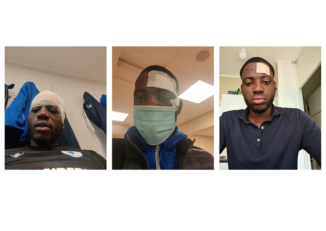 Hoe één pleister het begin werd van MultiTint